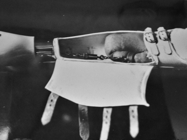 Protesi ad un braccio mutilato durante la guerra 