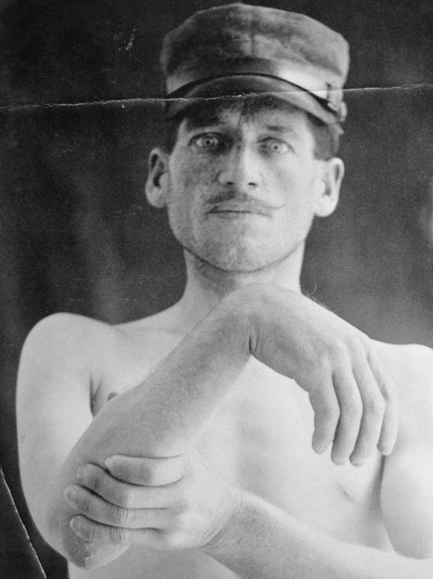 Mutilato di guerra 
