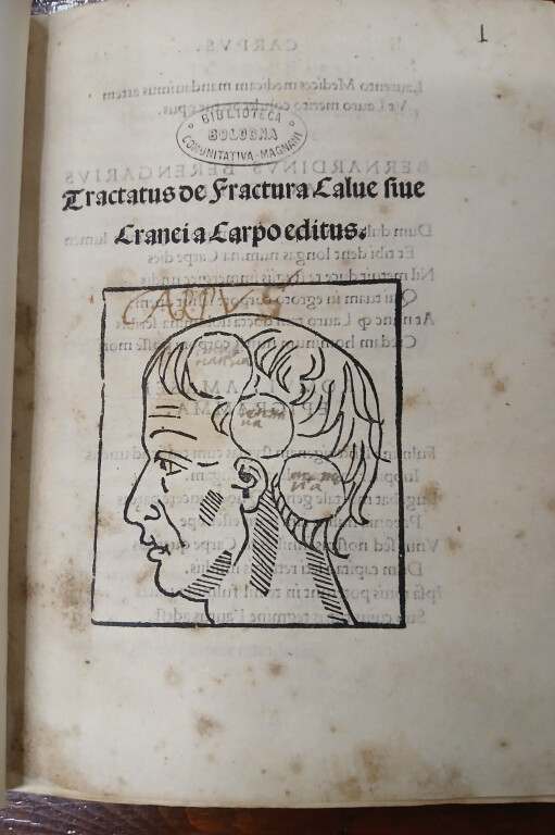 3.5 JACOPO BERENGARIO, Tractatus de fractura calve sive cranei   Bologna, Girolamo Benedetti, 1518. 4°